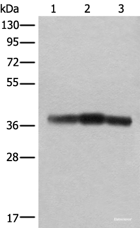 Western blot analysis of Rat brain tissue Mouse brain tissue and Human cerebrum tissue lysates using ATAD1 Polyclonal Antibody at dilution of 1:800
