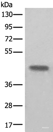 Western blot analysis of Human kidney tissue lysate using BHMT2 Polyclonal Antibody at dilution of 1:450