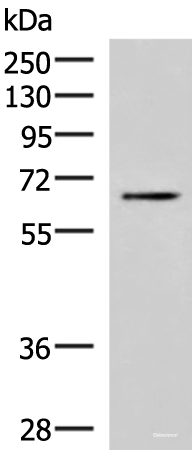 Western blot analysis of Jurkat cell lysate using BRD9 Polyclonal Antibody at dilution of 1:800