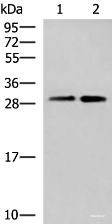 Western blot analysis of A549 cell and Human cerebrum tissue lysates using TBCB Polyclonal Antibody at dilution of 1:500