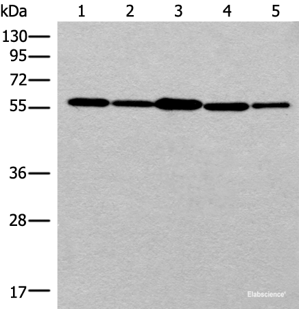 Western blot analysis of 293T cell HUVEC cell Hela cell lysates using RAD23B Polyclonal Antibody at dilution of 1:350
