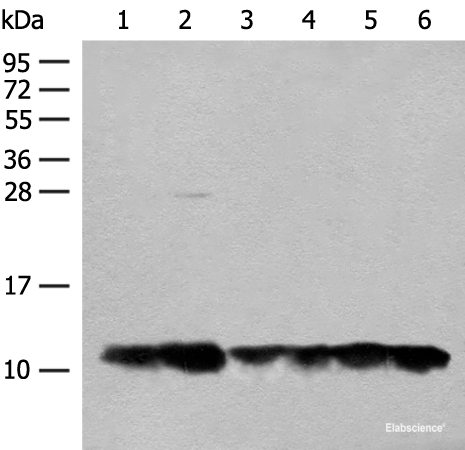 Western blot analysis of 293T cell Human fetal liver tissue lysates using ATP5L Polyclonal Antibody at dilution of 1:500