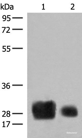 Western blot analysis of Human spleen tissue and A375 cell lysates using HLA-DRB1 Polyclonal Antibody at dilution of 1:500
