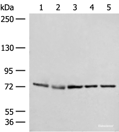 Western blot analysis of A172 231 Jurkat HepG2 and Hela cell lysates using POLH Polyclonal Antibody at dilution of 1:300