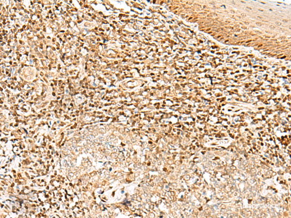 Immunohistochemistry of paraffin-embedded Human tonsil tissue using DNPEP Polyclonal Antibody at dilution of 1:30(×200)