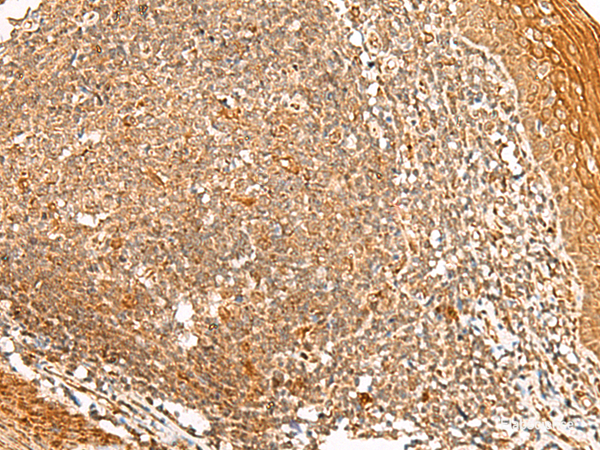 Immunohistochemistry of paraffin-embedded Human tonsil tissue using PPOX Polyclonal Antibody at dilution of 1:45(×200)