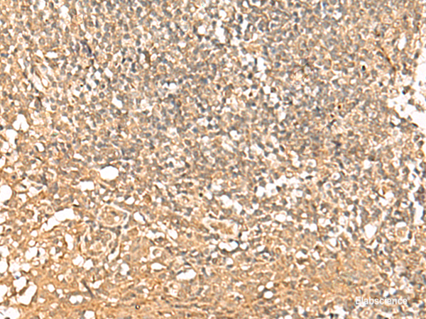 Immunohistochemistry of paraffin-embedded Human tonsil tissue using PWP1 Polyclonal Antibody at dilution of 1:50(×200)