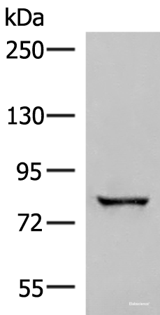 Western blot analysis of Human bladder transitional cell carcinoma grade 2-3 tissue lysate using TTC12 Polyclonal Antibody at dilution of 1:300