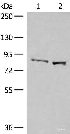 Western blot analysis of Human hepatocellular carcinoma tissue and HepG2 cell lysates using SLC26A3 Polyclonal Antibody at dilution of 1:250