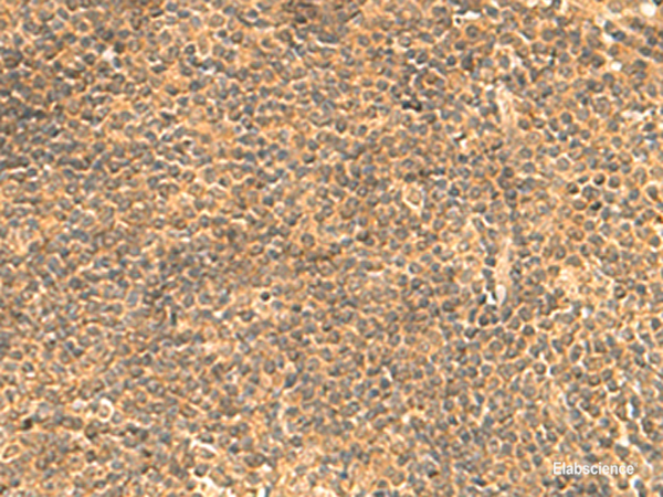 Immunohistochemistry of paraffin-embedded Human tonsil tissue using FAM186B Polyclonal Antibody at dilution of 1:25(×200)