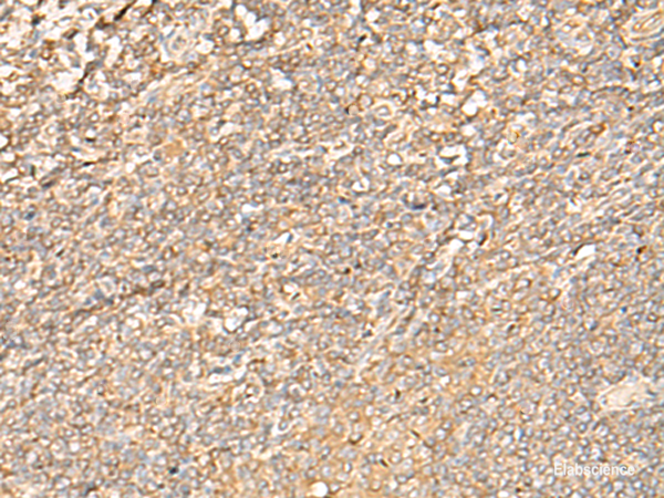 Immunohistochemistry of paraffin-embedded Human tonsil tissue using EIF3C Polyclonal Antibody at dilution of 1:35(×200)