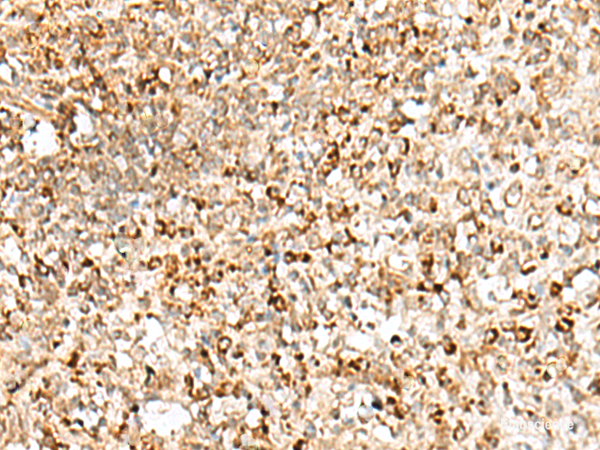 Immunohistochemistry of paraffin-embedded Human tonsil tissue using TEX11 Polyclonal Antibody at dilution of 1:50(×200)