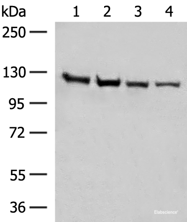 Western blot analysis of Human fetal brain tissue K562 cell Hela and A172 cell lysates using IPO11 Polyclonal Antibody at dilution of 1:450
