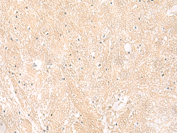 Immunohistochemistry of paraffin-embedded Human brain tissue using EMC1 Polyclonal Antibody at dilution of 1:35(×200)