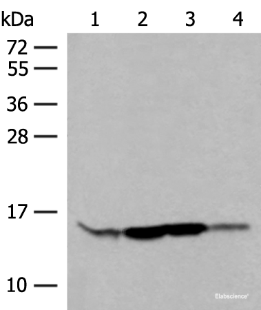 Western blot analysis of HL60 Hela 231 cell Human breast cancer tissue lysates using RPP14 Polyclonal Antibody at dilution of 1:400