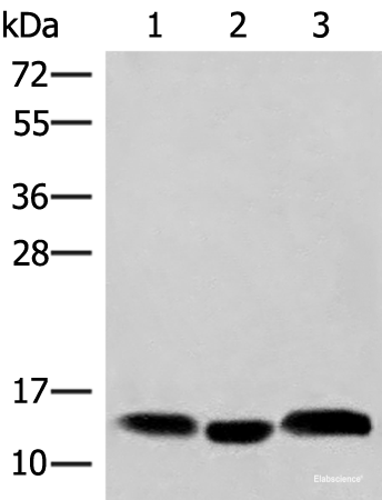 Western blot analysis of Human plasma solution Human placenta tissue Human gastric tissue lysates using HBE1 Polyclonal Antibody at dilution of 1:200
