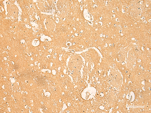 Immunohistochemistry of paraffin-embedded Human brain tissue using RNASE4 Polyclonal Antibody at dilution of 1:45(×200)