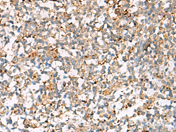 Immunohistochemistry of paraffin-embedded Human tonsil tissue using NPC2 Polyclonal Antibody at dilution of 1:50(×200)