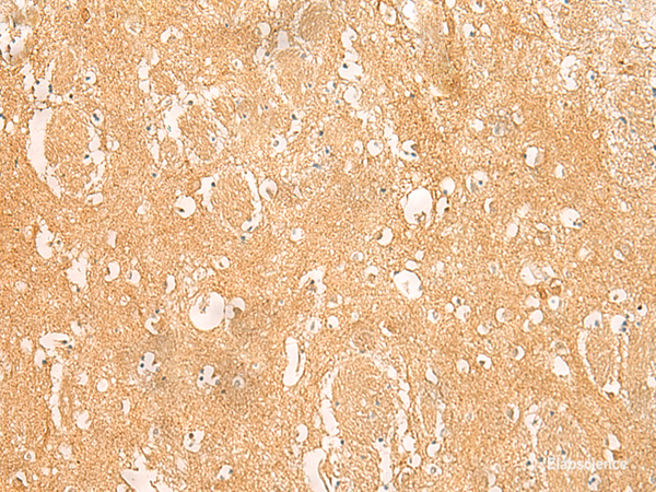Immunohistochemistry of paraffin-embedded Human brain tissue using ARPC5L Polyclonal Antibody at dilution of 1:45(×200)