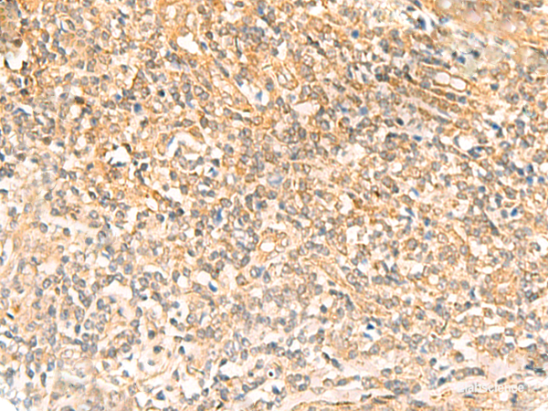 Immunohistochemistry of paraffin-embedded Human tonsil tissue using UBD Polyclonal Antibody at dilution of 1:50(×200)