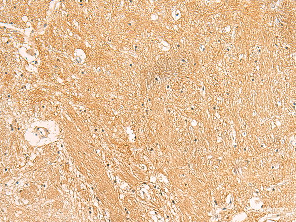 Immunohistochemistry of paraffin-embedded Human brain tissue using TXNDC12 Polyclonal Antibody at dilution of 1:50(×200)