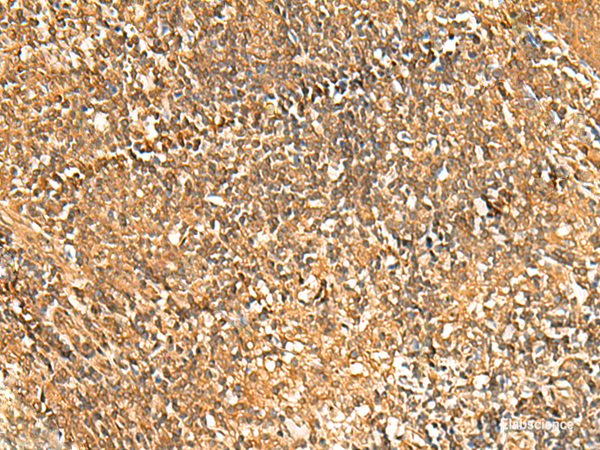 Immunohistochemistry of paraffin-embedded Human tonsil tissue using GSG1L Polyclonal Antibody at dilution of 1:50(×200)