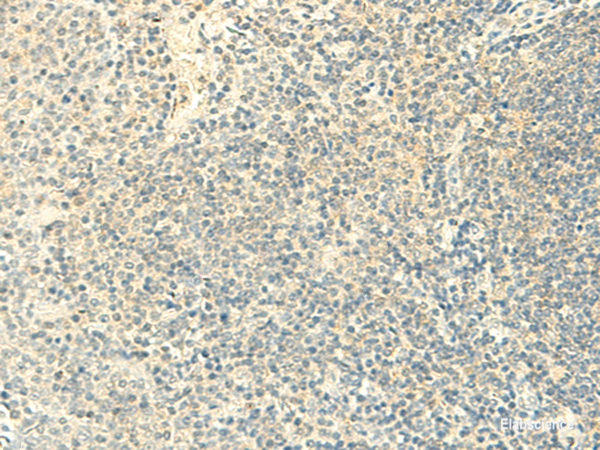 Immunohistochemistry of paraffin-embedded Human tonsil tissue using FMNL2 Polyclonal Antibody at dilution of 1:50(×200)