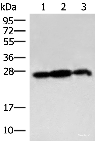 Western blot analysis of 293T cell and Rat brain tissue lysates using PDAP1 Polyclonal Antibody at dilution of 1:400