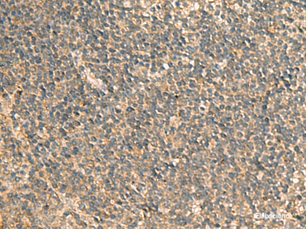Immunohistochemistry of paraffin-embedded Human tonsil tissue using GPBP1 Polyclonal Antibody at dilution of 1:65(×200)