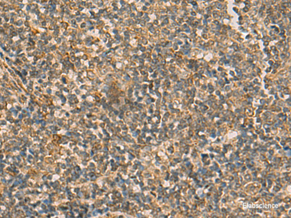 Immunohistochemistry of paraffin-embedded Human tonsil tissue using IFT22 Polyclonal Antibody at dilution of 1:50(×200)