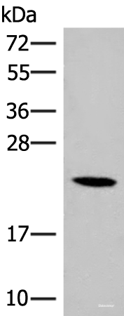 Western blot analysis of 293T cell lysate using DHFR Polyclonal Antibody at dilution of 1:400