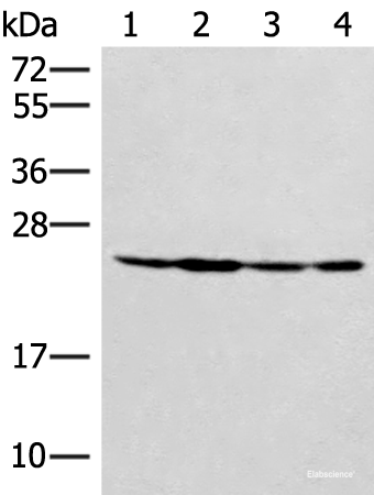 Western blot analysis of Hela 231 and A549 cell Mouse liver tissue lysates using SSSCA1 Polyclonal Antibody at dilution of 1:400