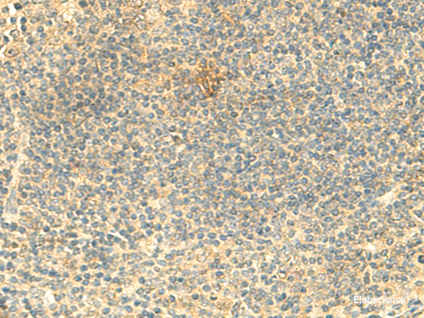 Immunohistochemistry of paraffin-embedded Human tonsil tissue using ARL4D Polyclonal Antibody at dilution of 1:50(×200)