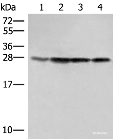 Western blot analysis of 231 Hela LOVO and A172 cell lysates using SEC22B Polyclonal Antibody at dilution of 1:500