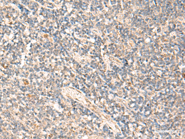 Immunohistochemistry of paraffin-embedded Human tonsil tissue using MOB1A Polyclonal Antibody at dilution of 1:50(×200)