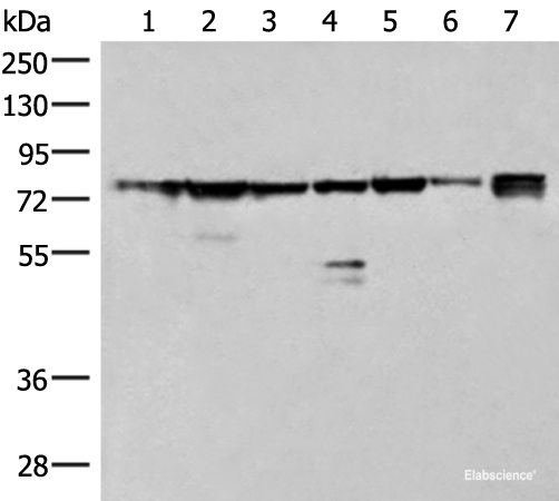 Western blot analysis of 231 K562 TM4 cell Mouse kidney tissue Mouse liver tissue Mouse brain tissue Hela cell lysates using THNSL1 Polyclonal Antibody at dilution of 1:500