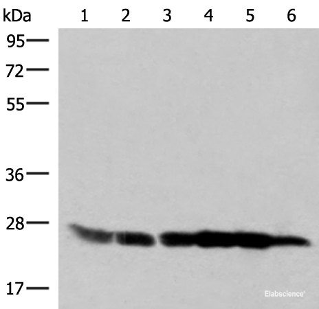 Western blot analysis of 293T HepG2 K562 HT29 A549 and Raji cell lysates using GSTK1 Polyclonal Antibody at dilution of 1:250