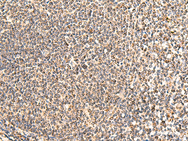 Immunohistochemistry of paraffin-embedded Human tonsil tissue using NEGR1 Polyclonal Antibody at dilution of 1:50(×200)