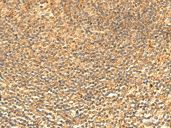 Immunohistochemistry of paraffin-embedded Human tonsil tissue using ABHD10 Polyclonal Antibody at dilution of 1:50(×200)
