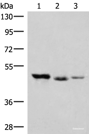 Western blot analysis of K562 and Jurkat cell Mouse kidney tissue lysates using HMBOX1 Polyclonal Antibody at dilution of 1:500