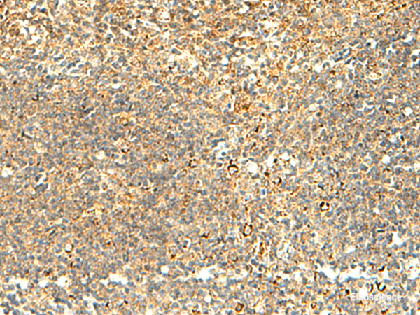 Immunohistochemistry of paraffin-embedded Human tonsil tissue using NAPRT Polyclonal Antibody at dilution of 1:50(×200)