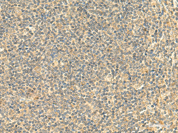 Immunohistochemistry of paraffin-embedded Human tonsil tissue using NTAN1 Polyclonal Antibody at dilution of 1:50(×200)