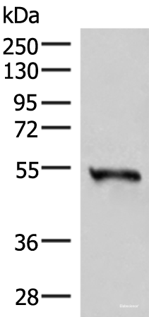 Western blot analysis of Human heart tissue lysate using RETREG1 Polyclonal Antibody at dilution of 1:300