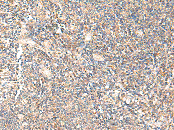 Immunohistochemistry of paraffin-embedded Human tonsil tissue using PPP1R3C Polyclonal Antibody at dilution of 1:50(×200)