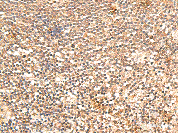 Immunohistochemistry of paraffin-embedded Human tonsil tissue using TRAPPC1 Polyclonal Antibody at dilution of 1:60(×200)