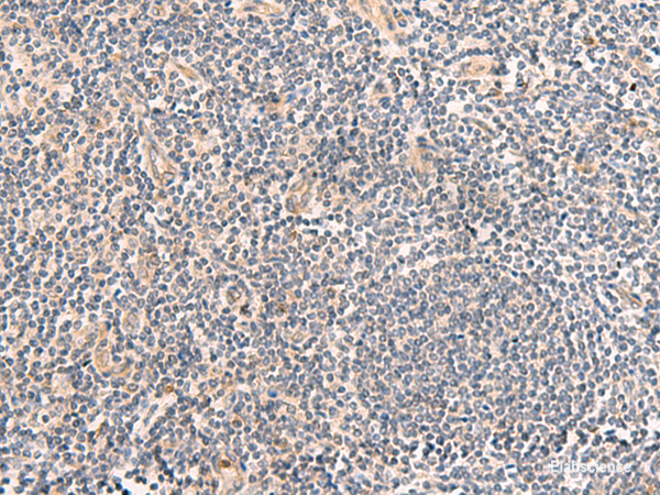 Immunohistochemistry of paraffin-embedded Human tonsil tissue using TEAD3 Polyclonal Antibody at dilution of 1:50(×200)