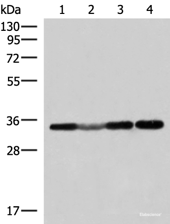 Western blot analysis of 293T and Hela cell Human fetal liver tissue lysates using ECH1 Polyclonal Antibody at dilution of 1:300