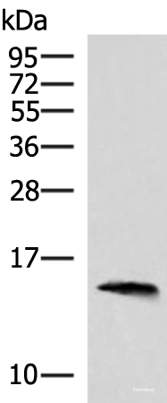 Western blot analysis of Human pancreas tissue lysate using REG1B Polyclonal Antibody at dilution of 1:800