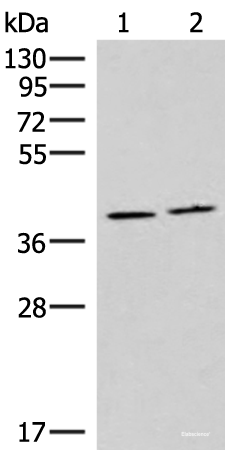 Western blot analysis of Human placenta tissue and Human fetal brain tissue lysates using HMGCLL1 Polyclonal Antibody at dilution of 1:1000