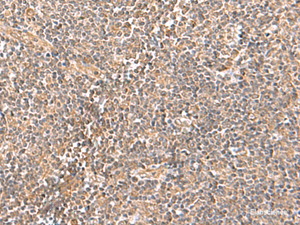 Immunohistochemistry of paraffin-embedded Human tonsil tissue using TRUB1 Polyclonal Antibody at dilution of 1:70(×200)